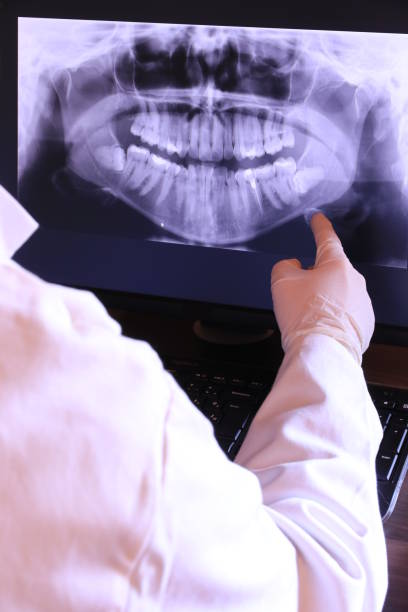 Best Cracked Tooth Emergency Dentist  in Kettering, OH