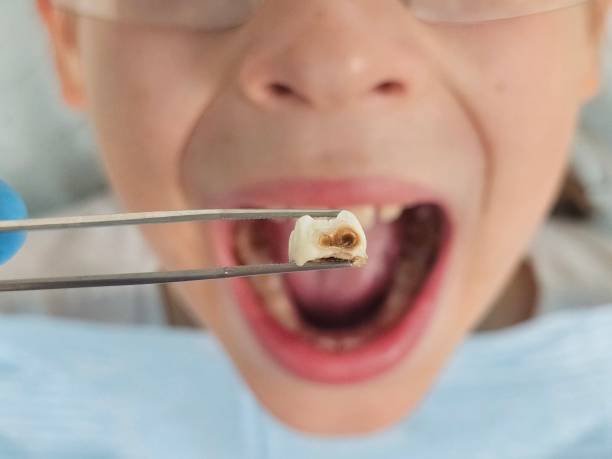 Best Emergency Gum Pain Relief  in Kettering, OH